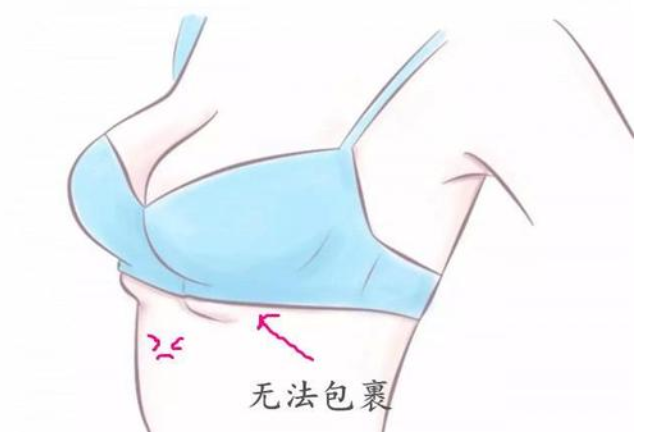 乳腺凝胶贴牌加工.png