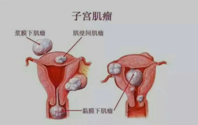 妇科凝胶贴牌