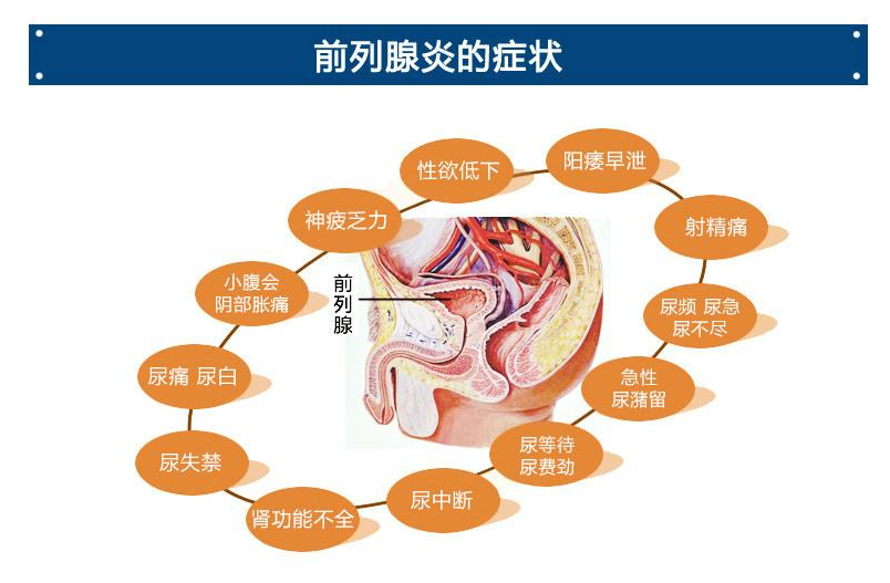 前列腺贴生产厂家