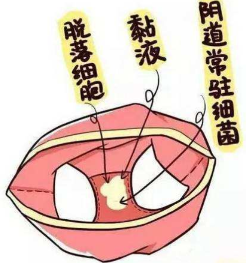 妇科凝胶OEM