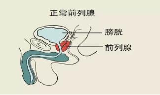 前列腺贴牌厂家